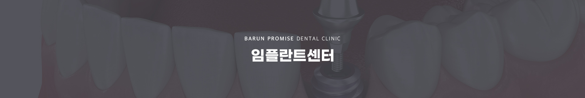 임플란트센터
