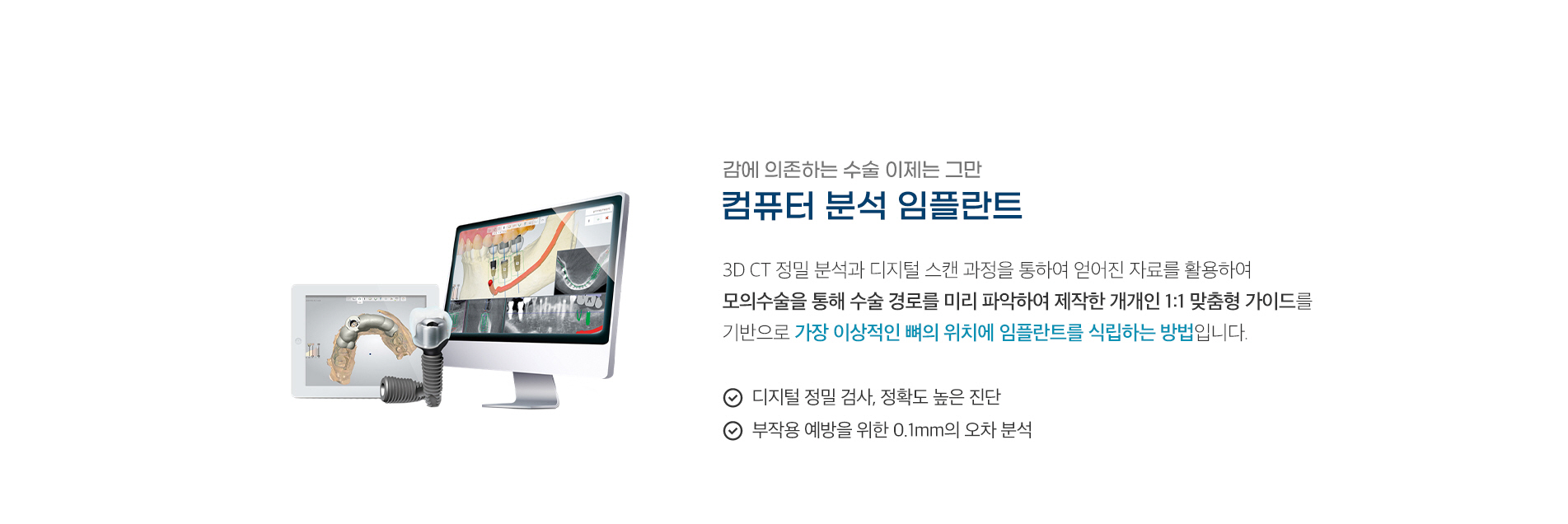 컴퓨터 분석 임플란트