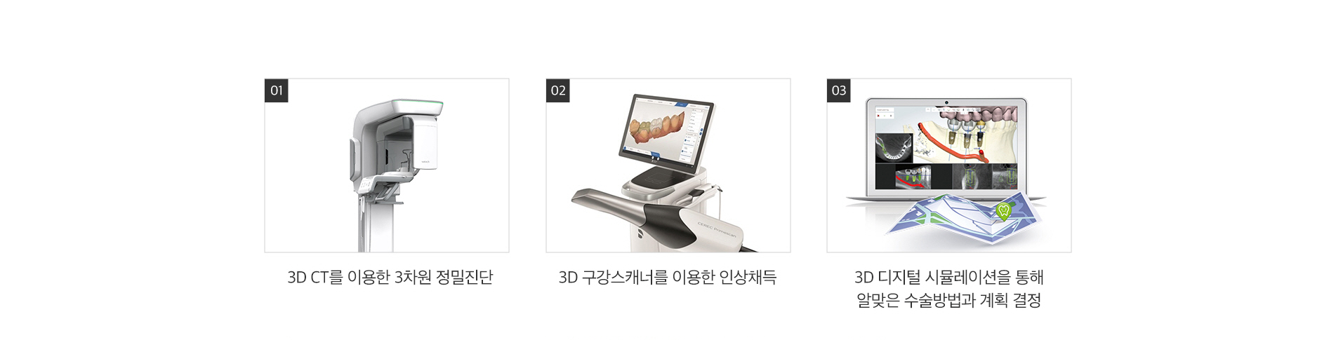 컴퓨터 분석 임플란트