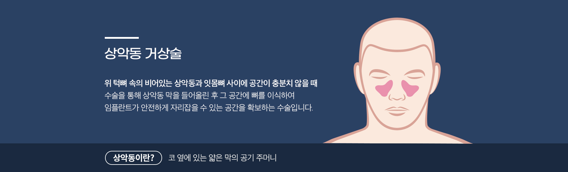상악동 거상술