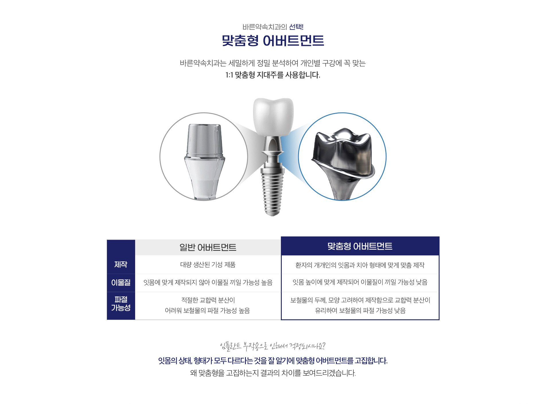 맞춤형 어버트먼트