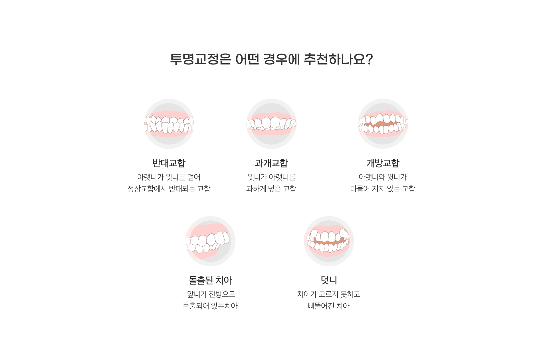 투명교정은 어떤 경우에 추천하나요?