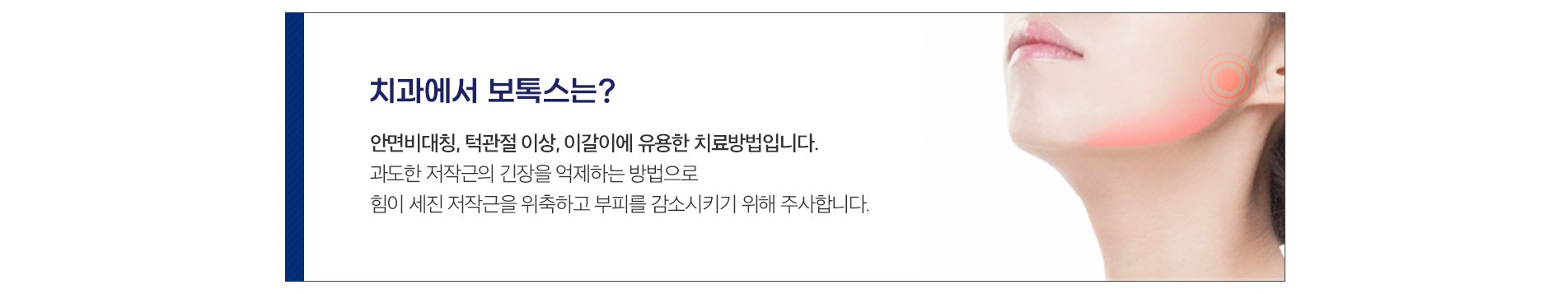 치과에서 보톡스는?