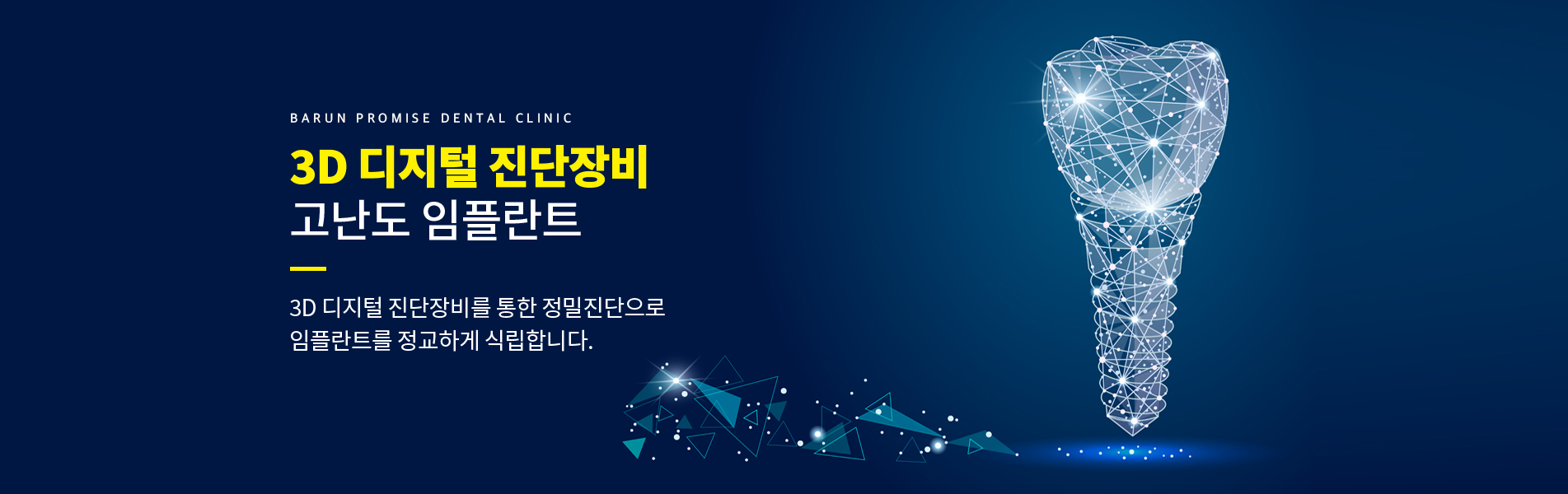 3D 디지털 진단장비 고난도 임플란트